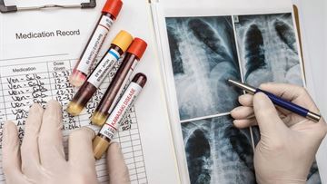 The European Health Data Space and rare diseases