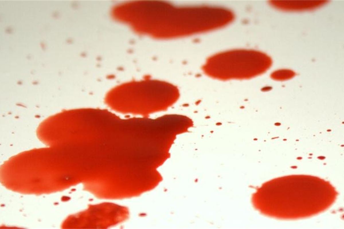 Пошла сильно кровь. Ярко красный цвет крови.